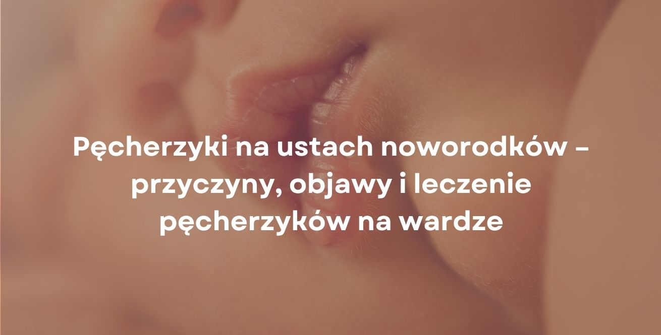 Pęcherzyki na ustach noworodków – przyczyny, objawy i leczenie pęcherzyków na wardze