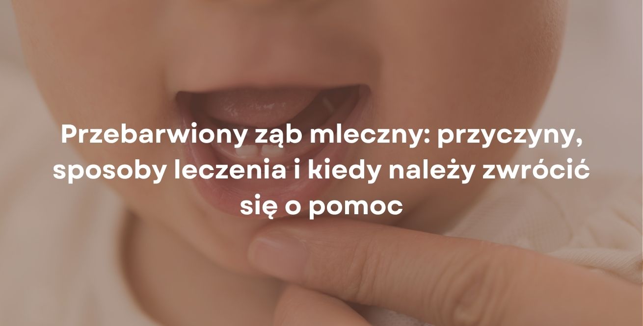 Przebarwiony ząb mleczny: przyczyny, sposoby leczenia i kiedy należy zwrócić się o pomoc