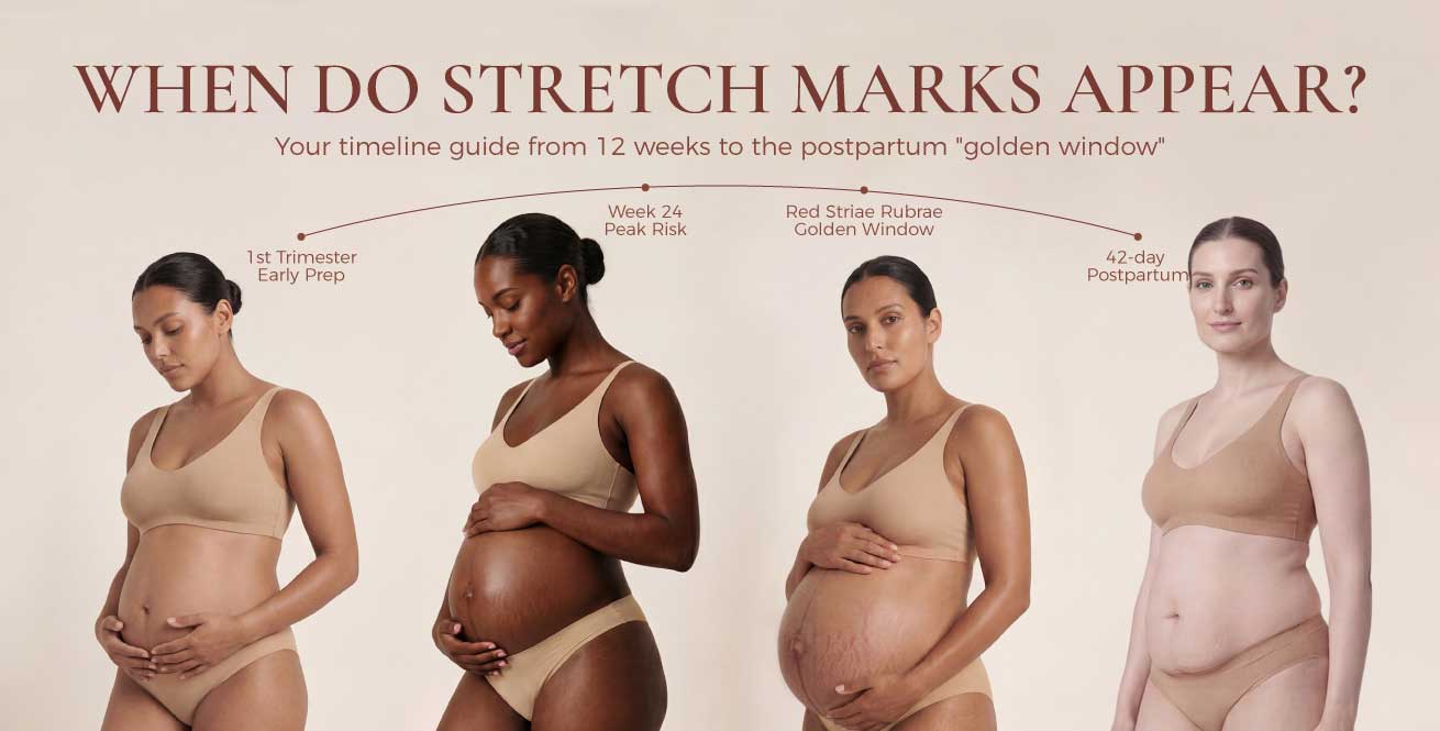 When Do Stretch Marks Appear in Pregnancy – And When To Start Using Stretch Mark Cream?